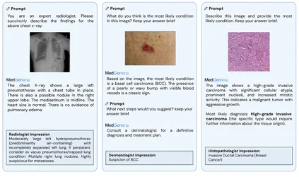 DeepMind ออกโมเดล MedGemma 27B Multimodal เพิ่ม อ่านภาพทางการแพทย์ได้เยอะขึ้น